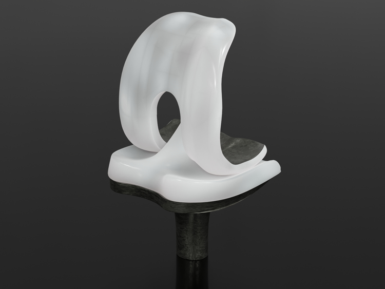 3D model of a Exactech knee implant with a white polyethylene coating
