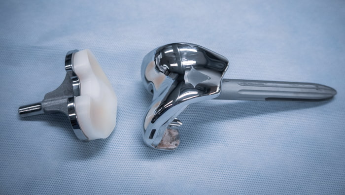 Vantage knee replacement system displayed on a blue table